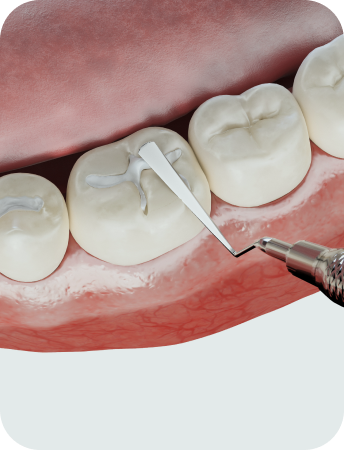 바른치아 일반진료